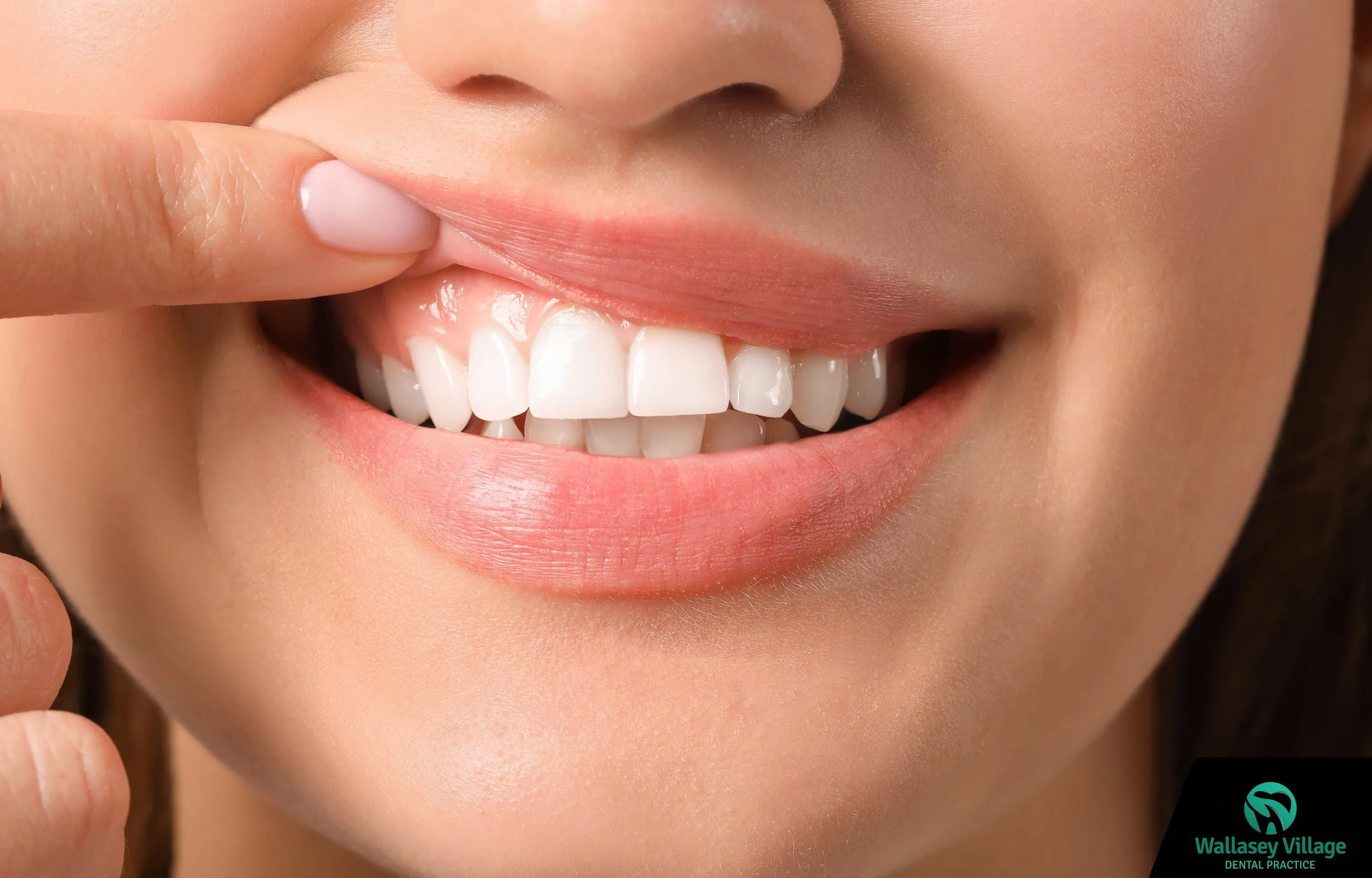 The Benefits of Teeth Whitening: What to Expect