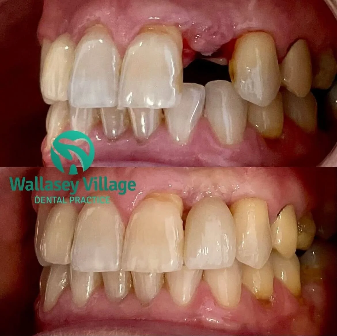 B_A Dental Implants.jpg