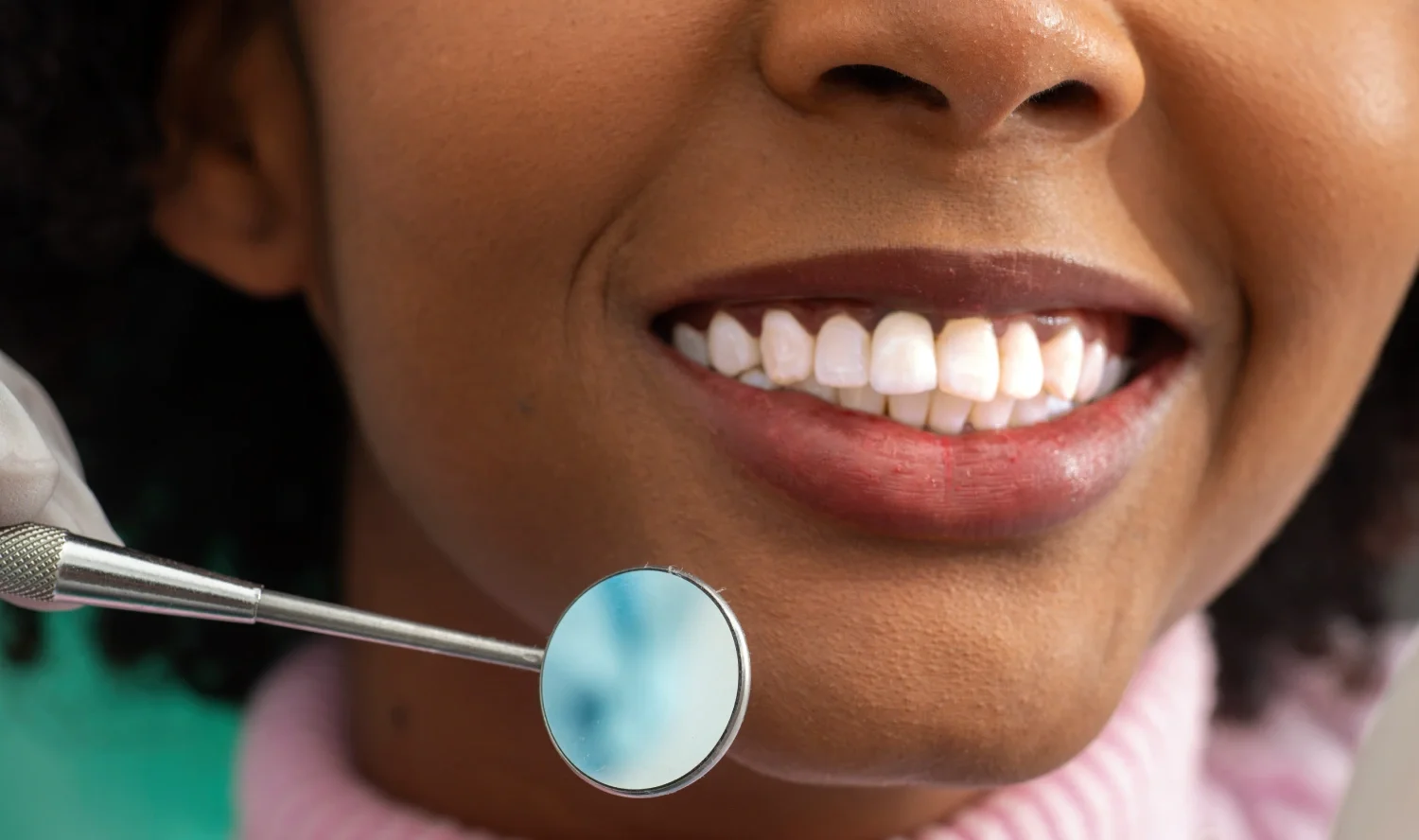 How Many Teeth Can You Get Composite Bonding On?