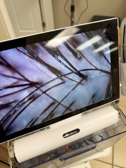 5 Signs Your Scalp Needs a Detox