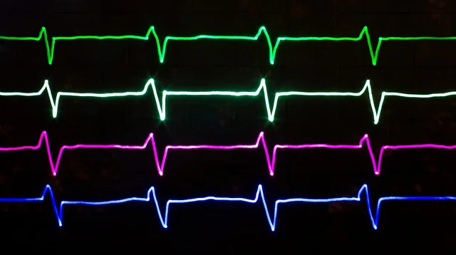 Is Your Competitive Analysis on Life Support?