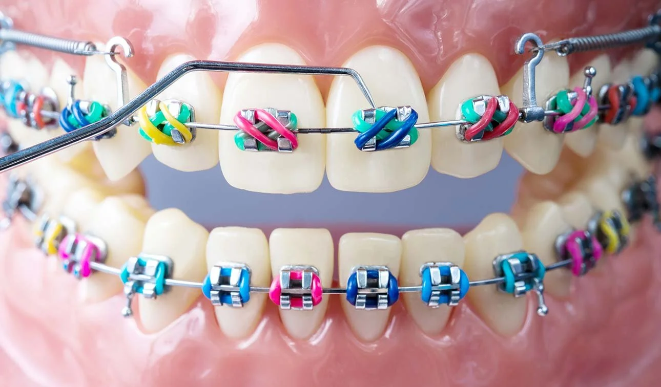 Masterclass Orthodontie