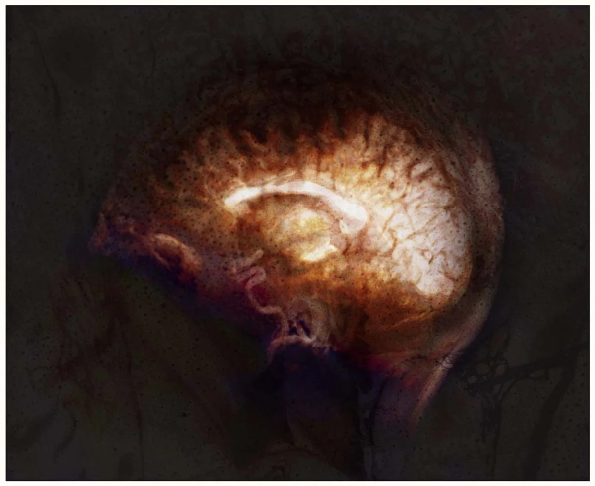 Glowy brain with floating colors (red threads)