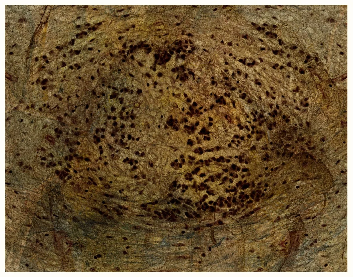 Rainforest forms with neurons (sacral spinal cord)