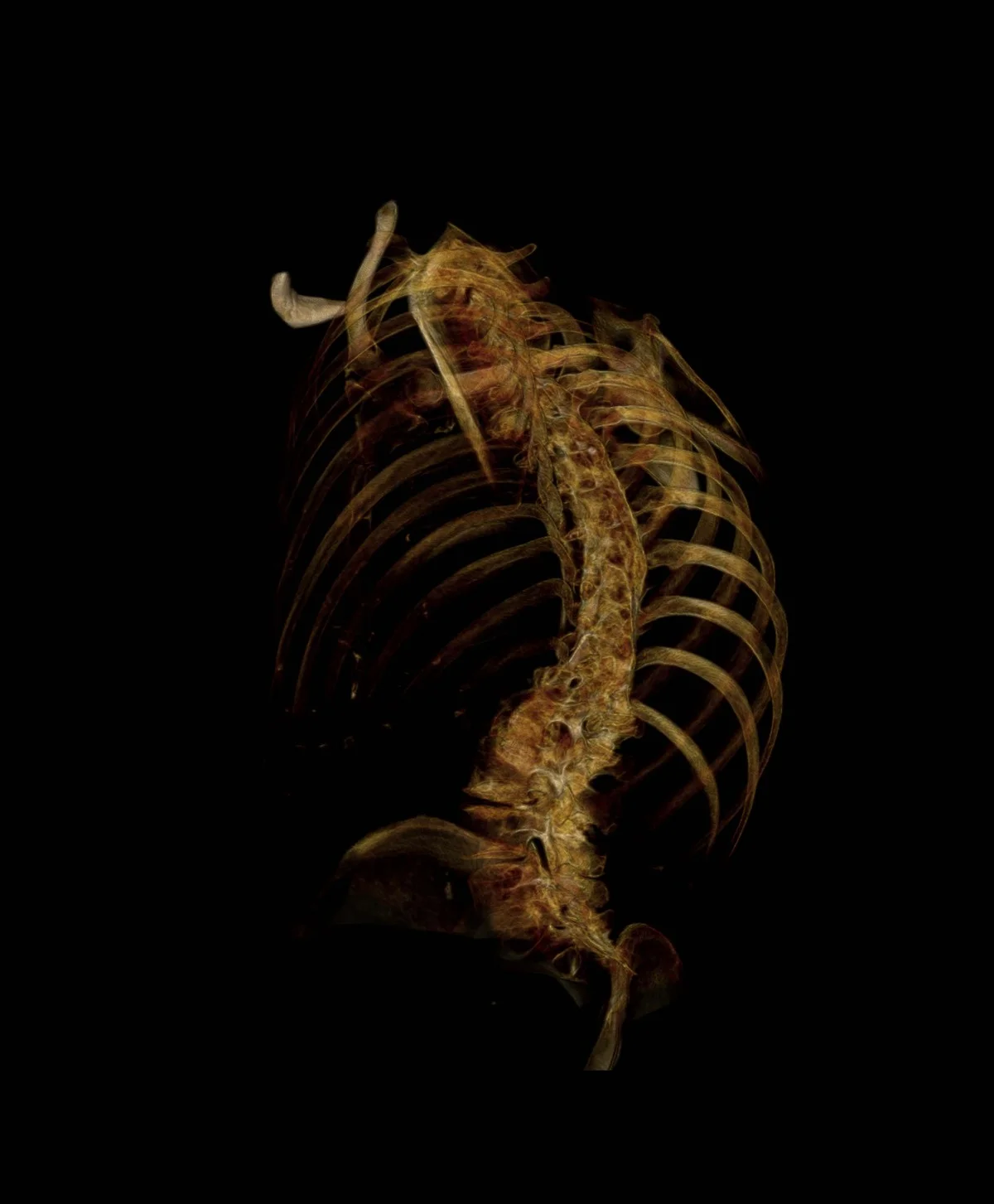 Gold-black skeleton (#8)