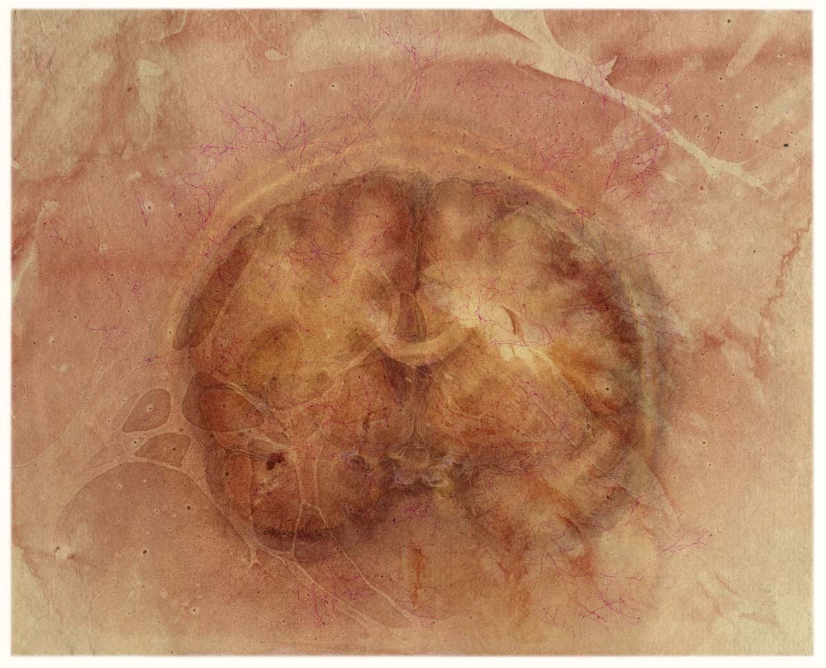  Cerebrum, coronal view, with floating colors (rosy kozo)    