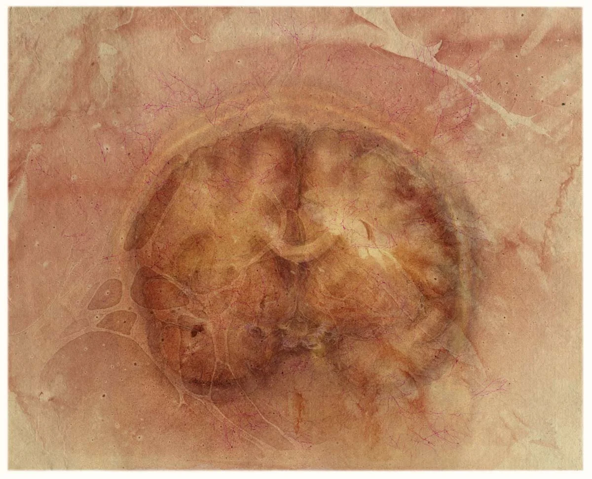 Cerebrum, coronal view (rosy kozo)