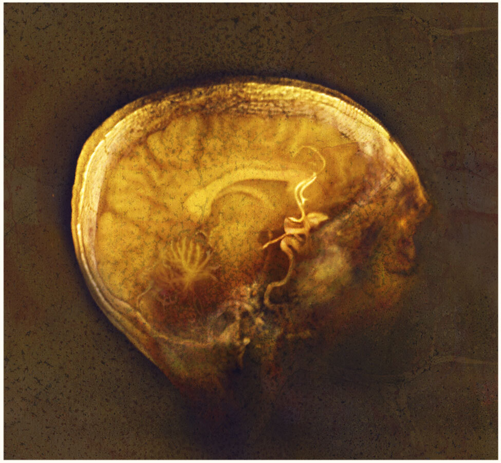 gold-black_brain_gold_bergerac-3a-ltn.jpg