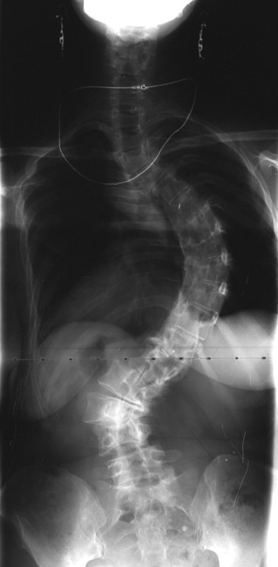 X-ray made for the purpose of art