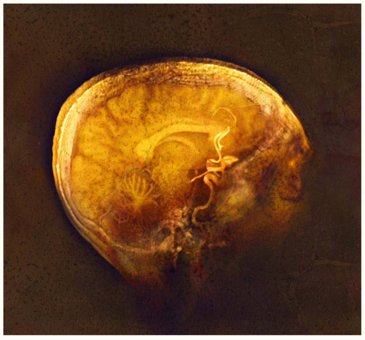 Gold-black brain (Bergerac)