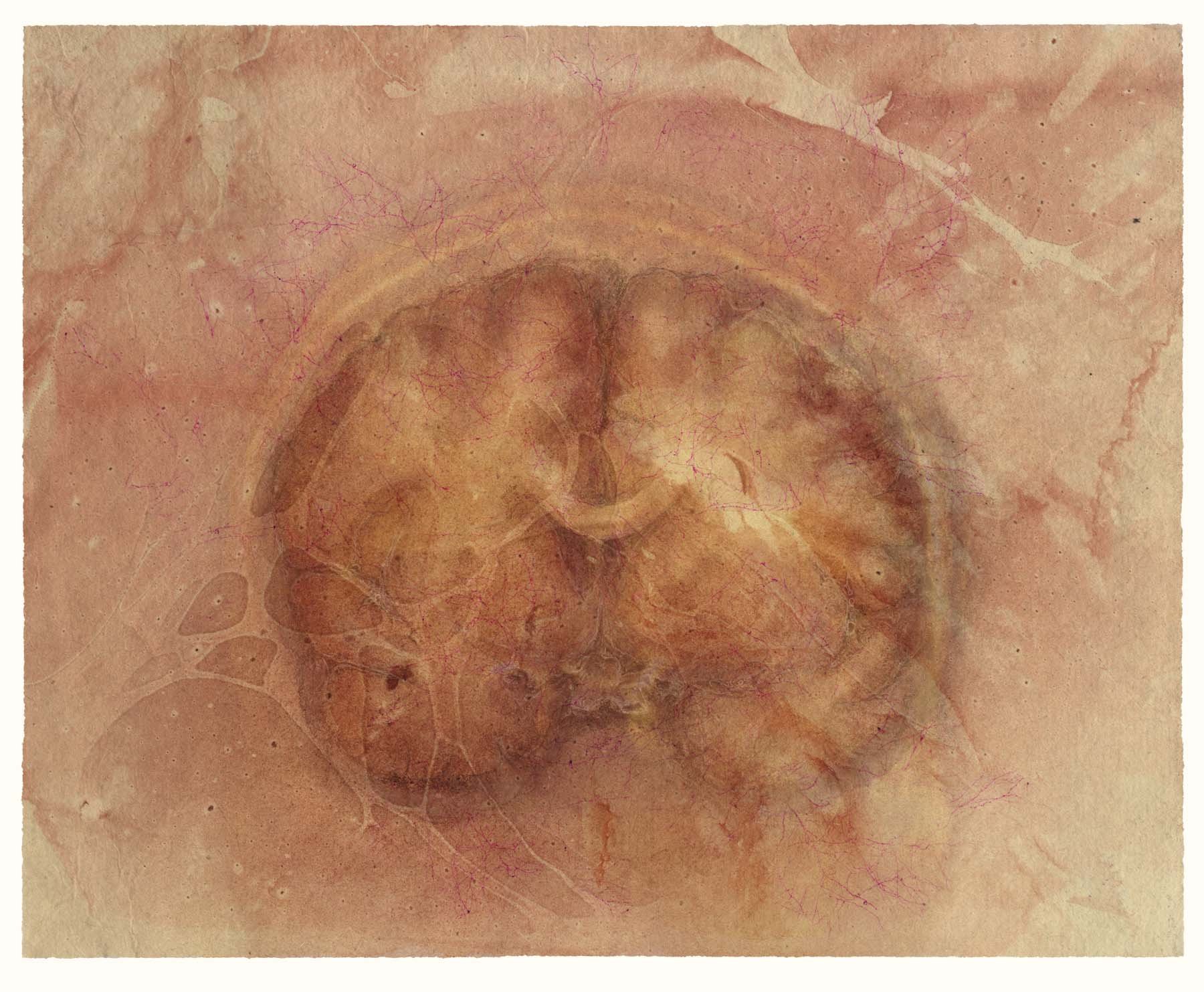 Cerebrum, coronal view, with floating colors (rosy kozo)