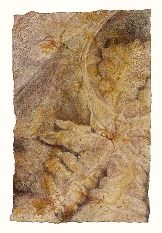 arbor-vitae+4th-ventricle+yellow-8fcc-72.jpg