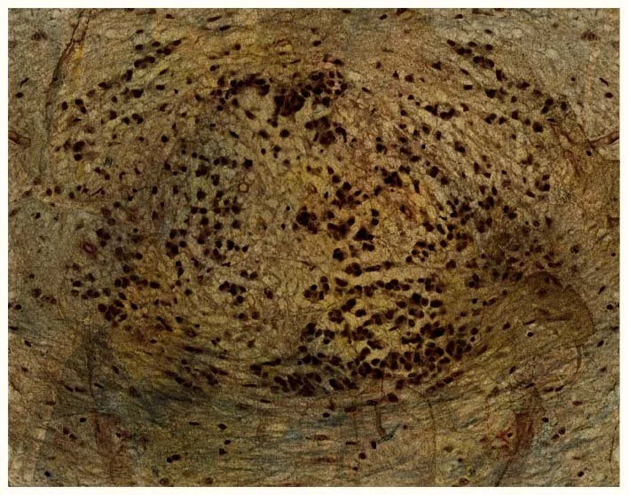 Sacral spinal cord neurons (rainforest forms)