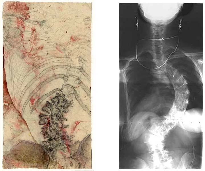  Spine scroll, 19 x 10 in., 1993, and full-spine x-ray with earrings and necklace, 1995 