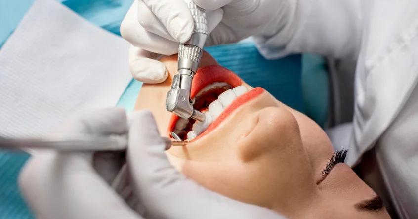 teeth-cleaning-before-after-846x443.jpg