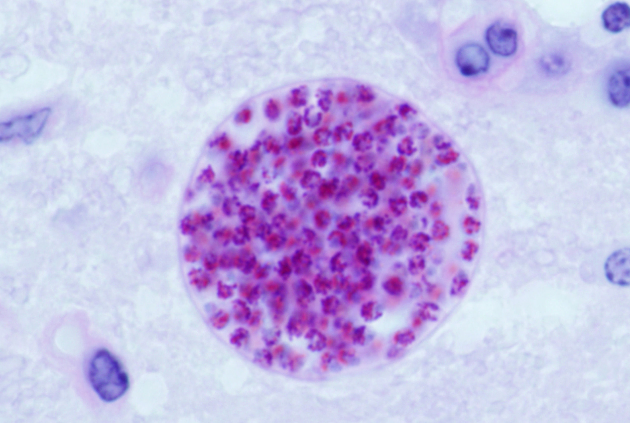 American Parasite