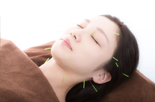 Facial (Cosmetic) Acupuncture
