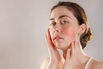 Eczema Awareness Week 2026: 10 Expert Tips for Winter Eczema