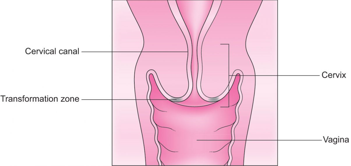 Cervical erosion during pregnancy
