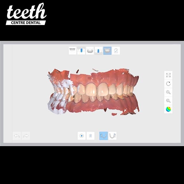 La millor tecnologia amb esc&agrave;ner intraoral la podr&agrave; trobar a @teethcentredental #badalona #mediti500