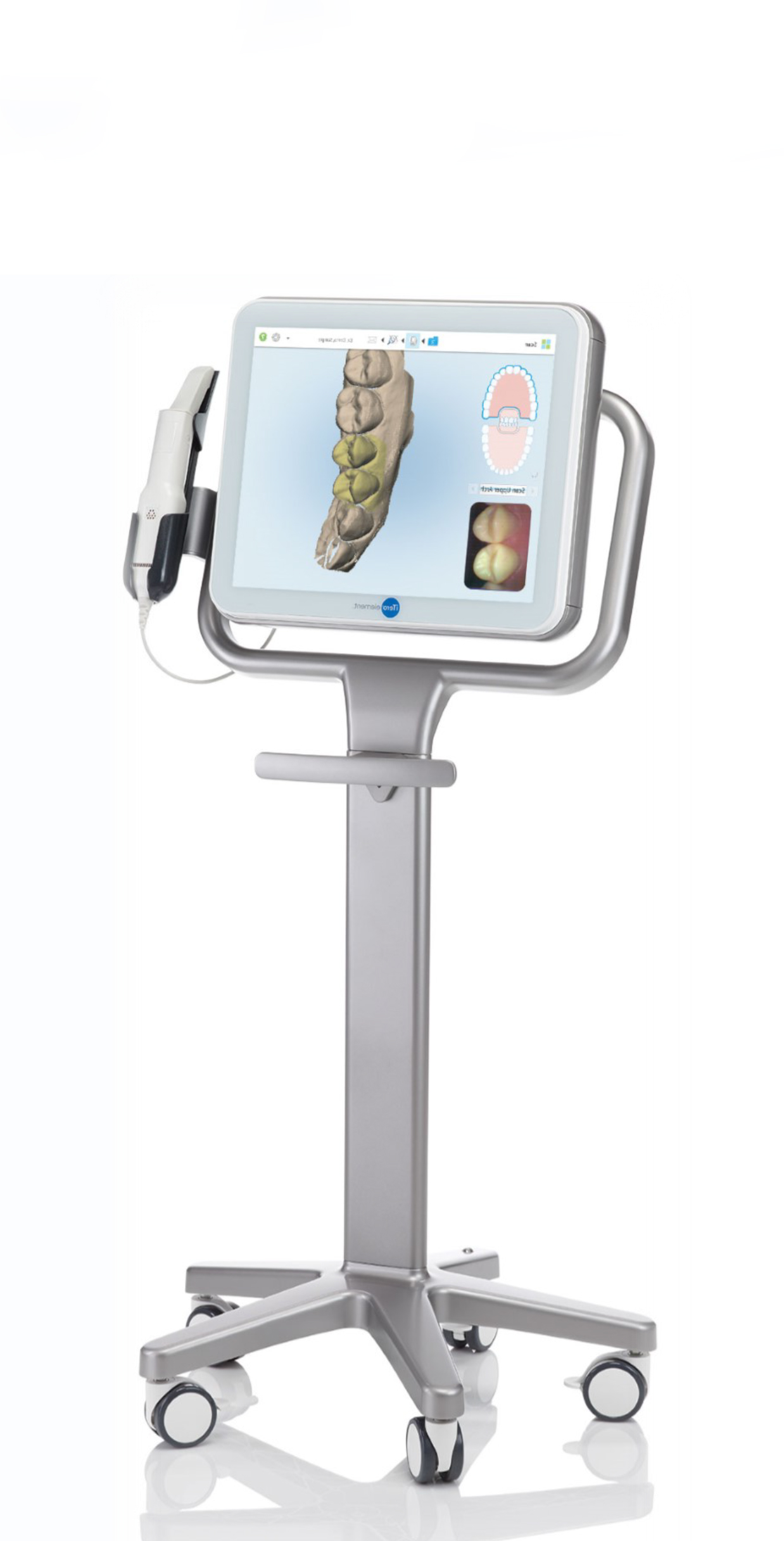 ITERO SCANNER — Valiente Dental