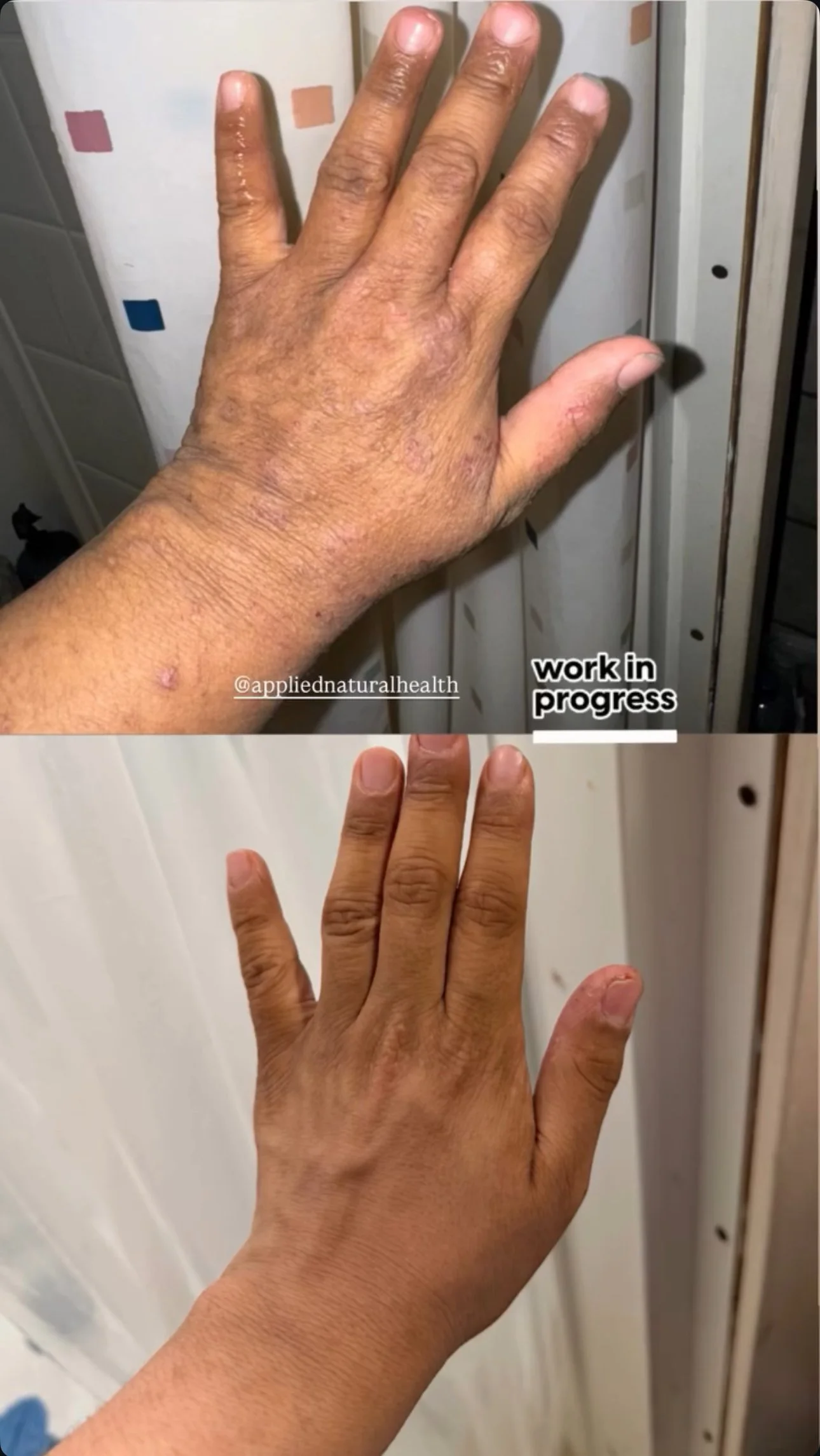 Starting point- hand .PNG