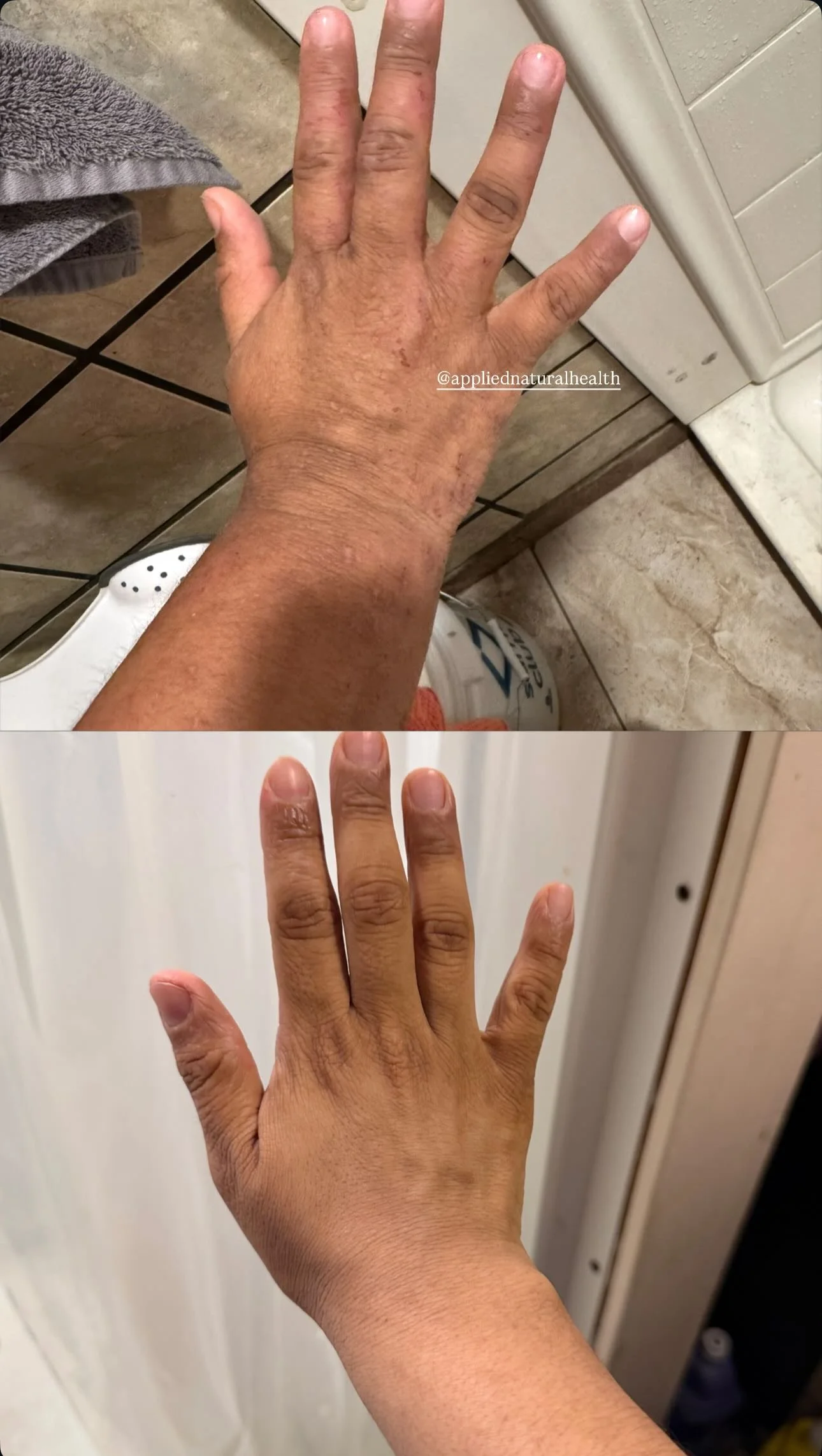 Hands progress.PNG