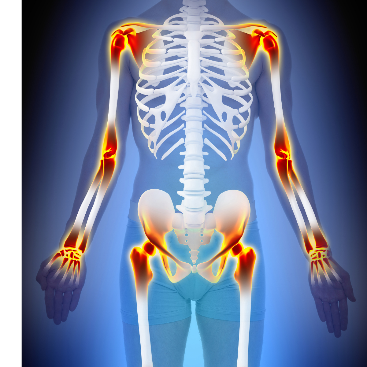 Do You Have Inflammation? 5 Ways to Reduce It.