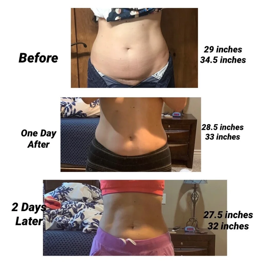 ultrasound cavitation skinworks