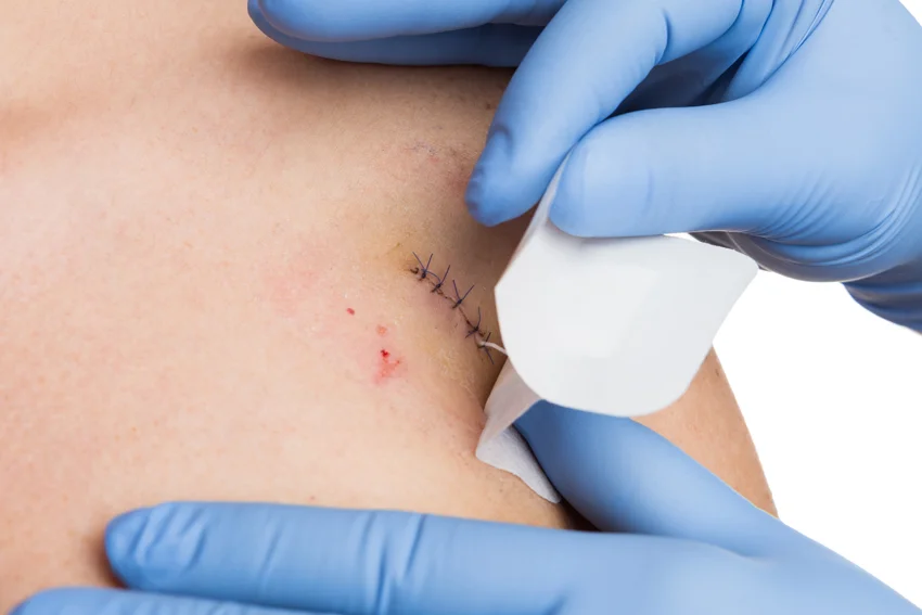 Skin Surgery Dermatology.jpg
