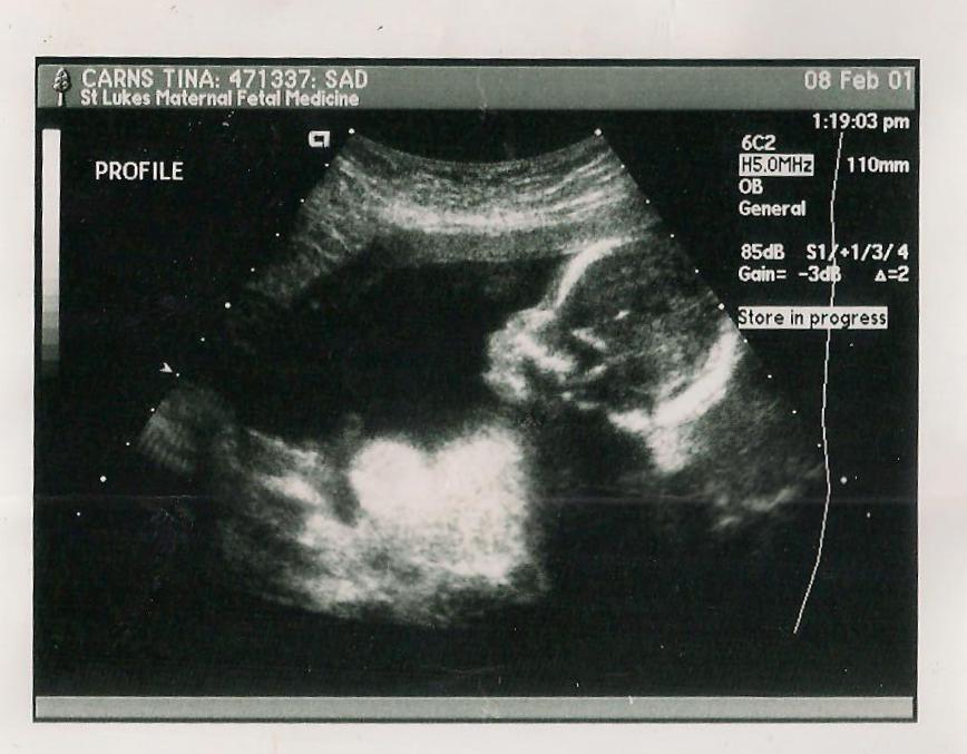 ultrasound.jpeg