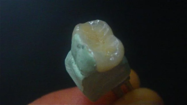 inlay2.jpg