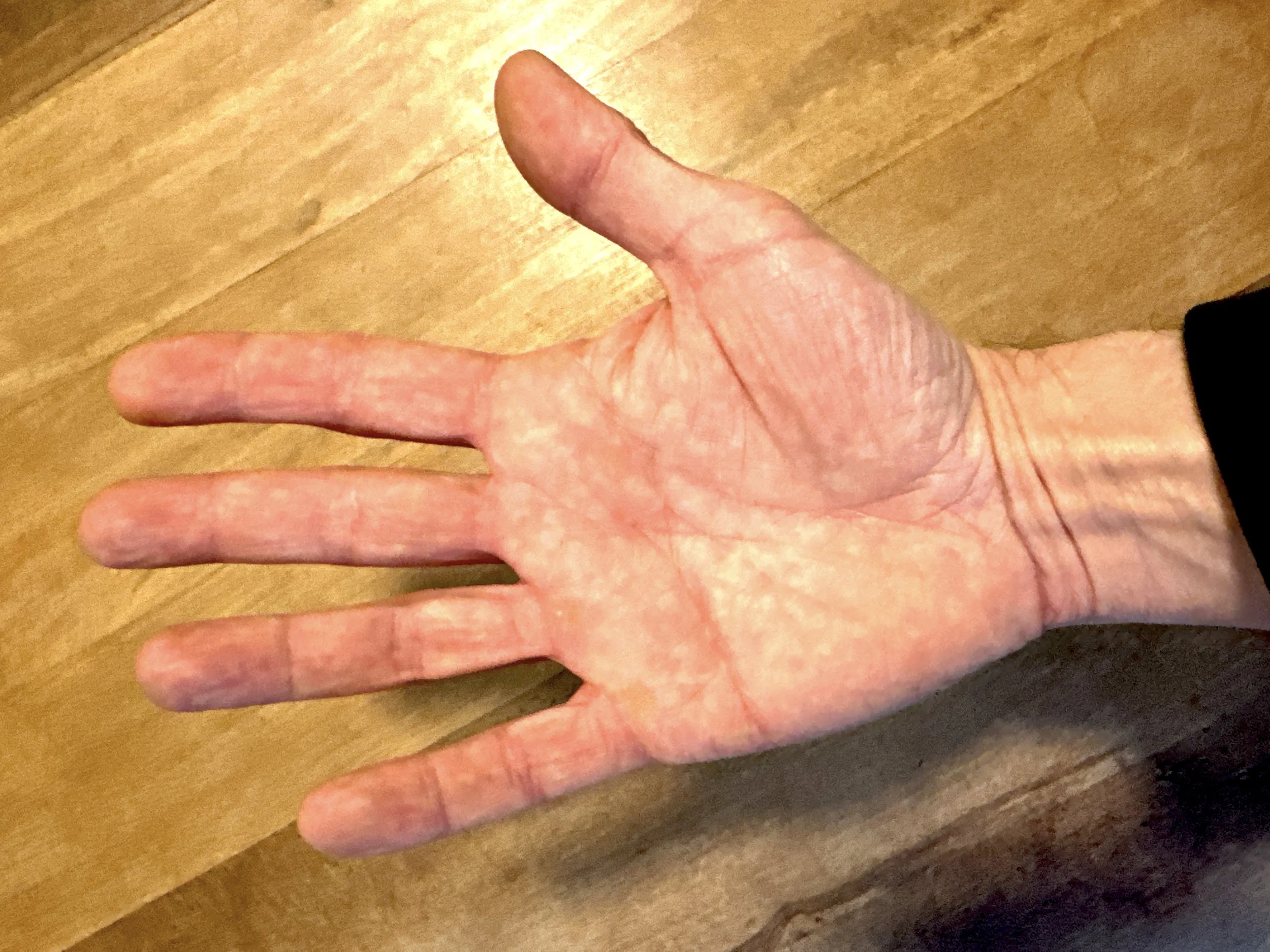 Bewusstes Betrachten der Handfläche: Eine Übung in Achtsamkeit