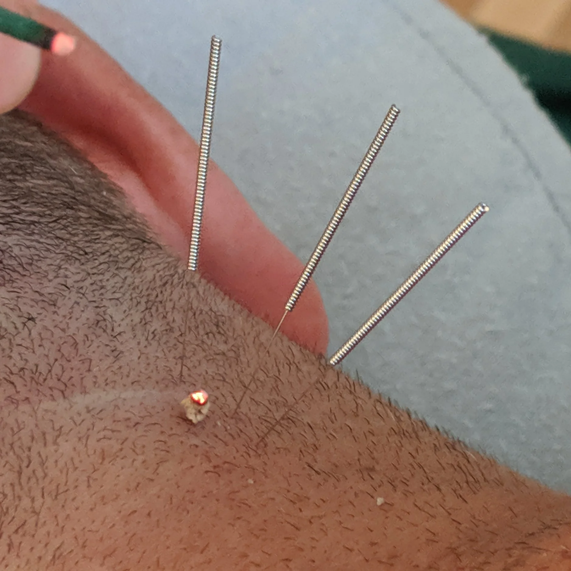 Licensed Acupuncturist Kailua Kona HI Traditional Chinese Herbal