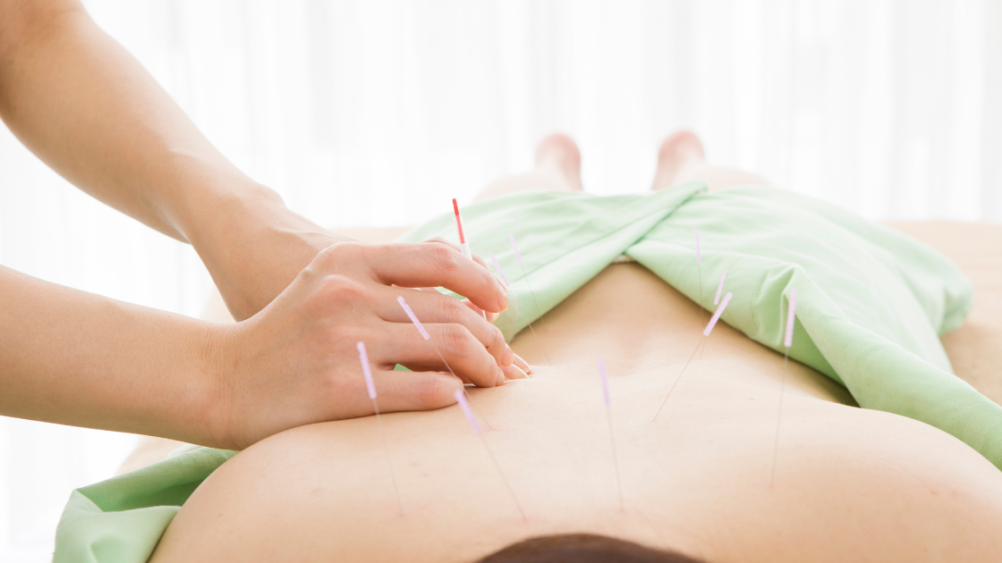 Can Acupuncture Help Treat Back Pain?