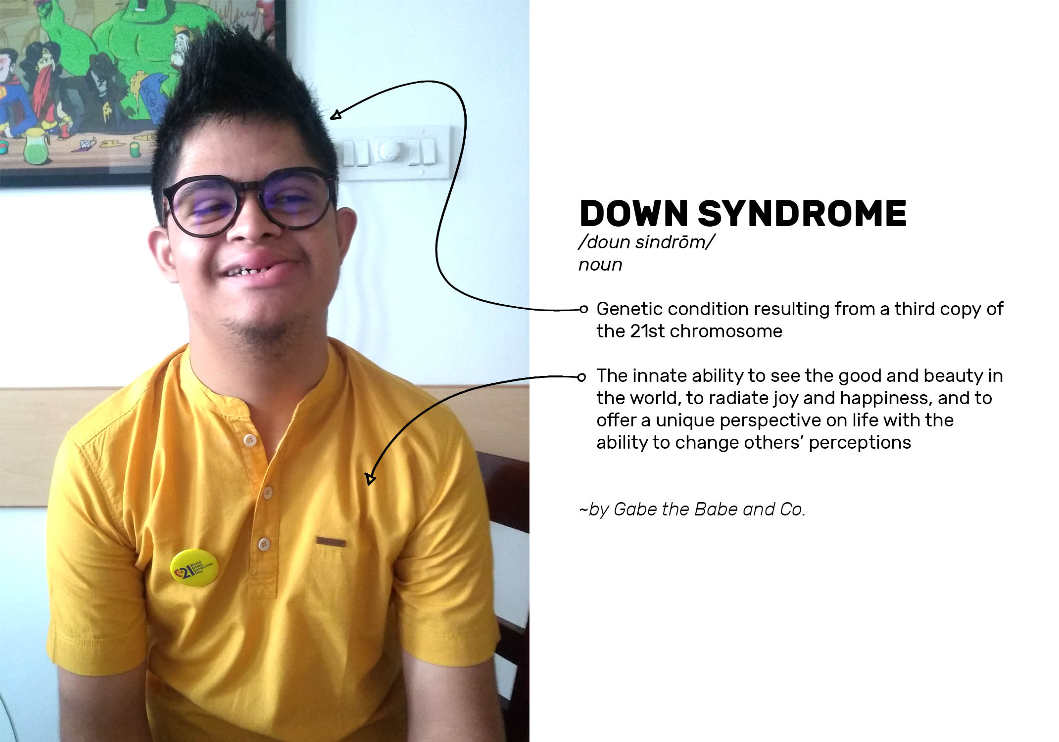 Jijo is not a Down Syndrome Individual