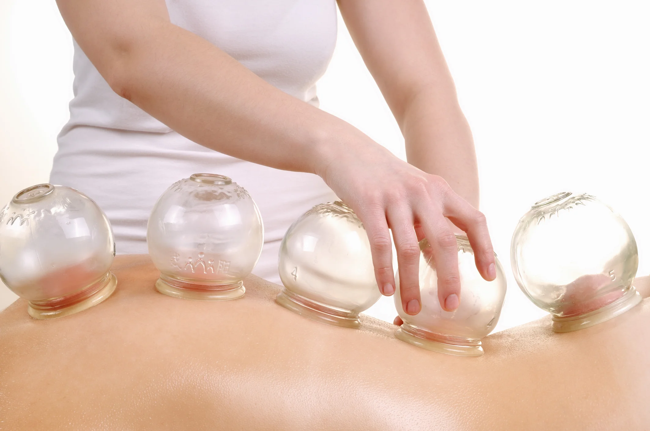 cupping.jpg