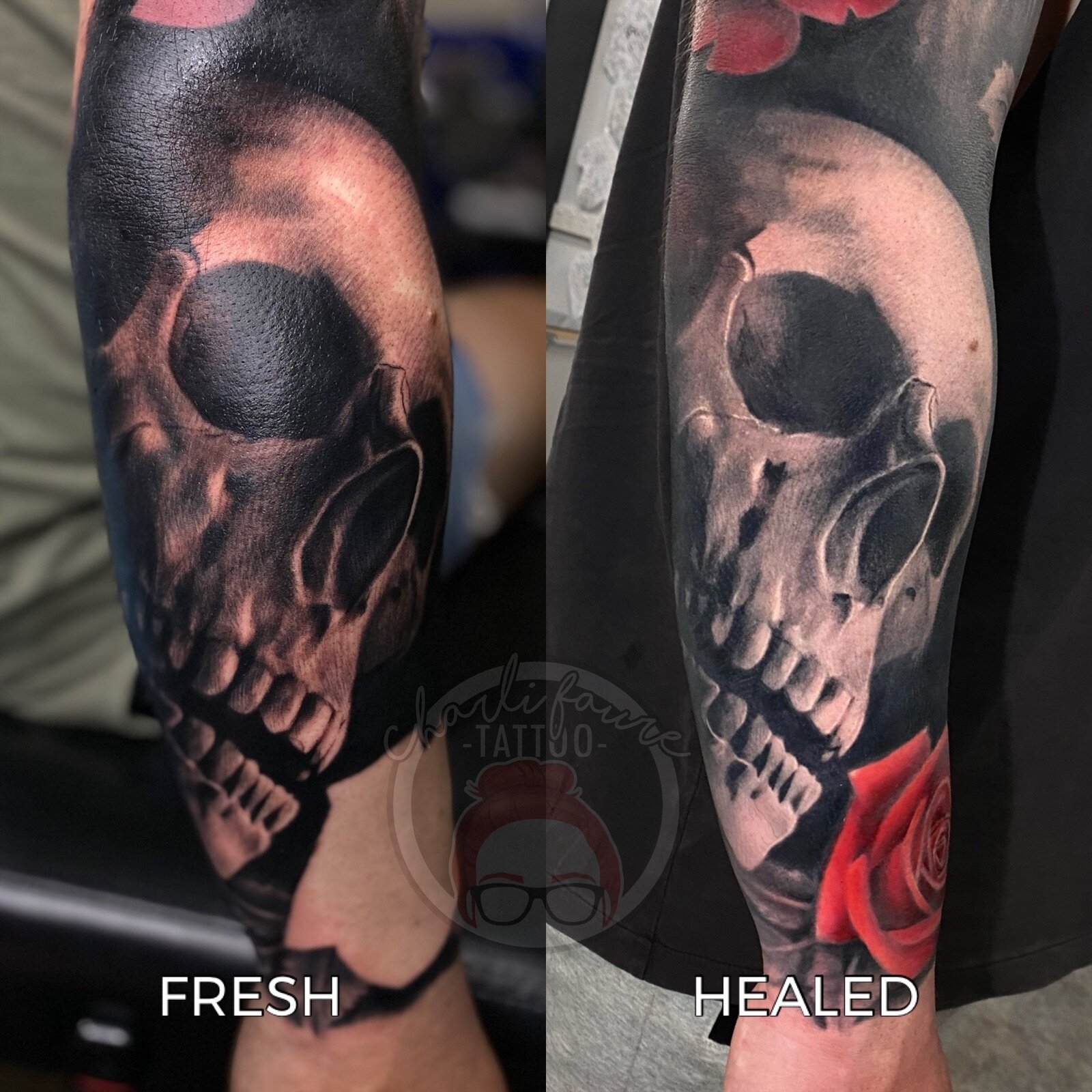 How Long to Leave Saniderm on a Tattoo  TattooProfy