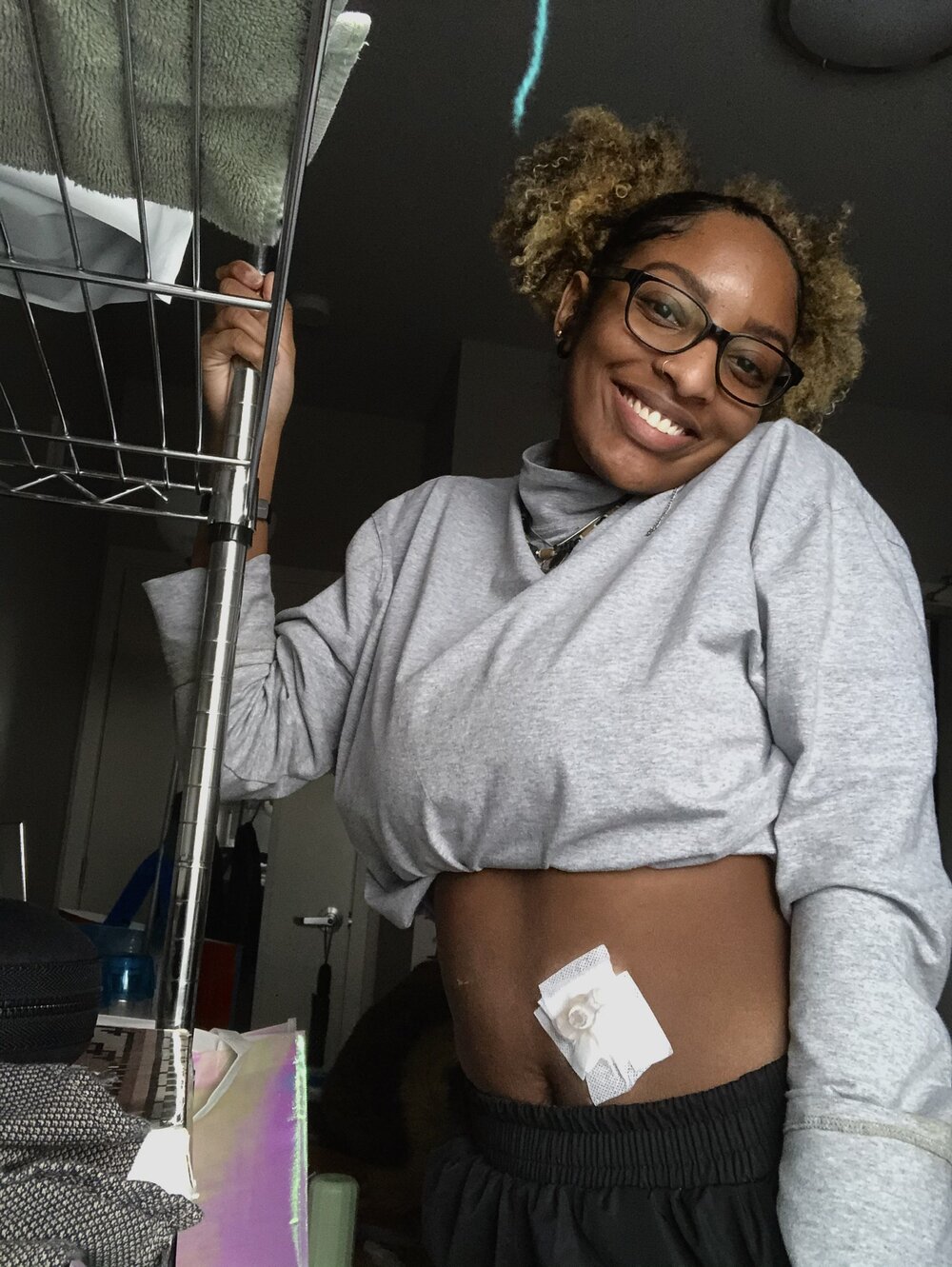 Damarius Ingram with her top pulled up to show her gastrostomy feeding tube. Photo: Damarius Ingram
