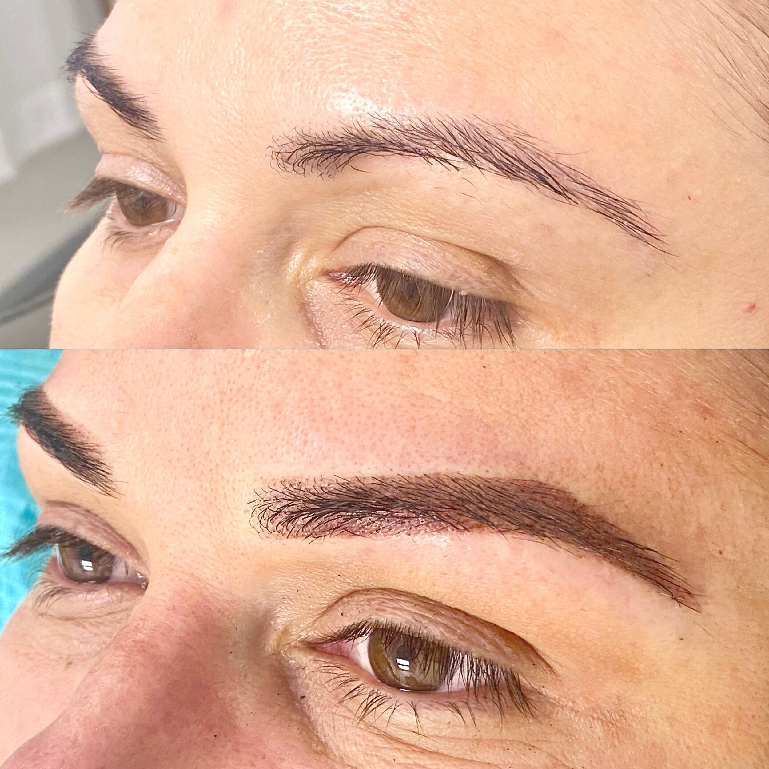 Ombre Powdered BrowsOmbré Powdered Brows have become the latest “in-thing” of the cosmetic brow industry.It is a soft, defined pixilated pattern that is lighter at the front and darker at the tail creating the illusion of powdered makeup.Lasts up to…