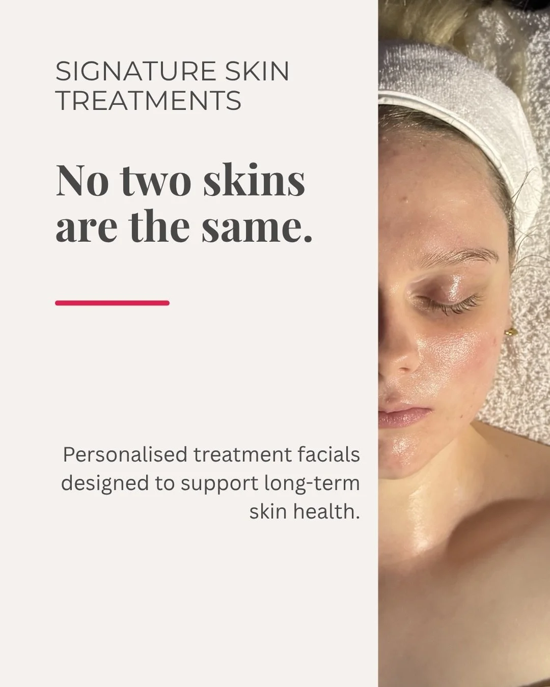 No two skins are the same. &hearts;️

At Sibu, our Signature Skin Treatments are personalised treatment facials designed to support your skin concerns, barrier health and long-term skin goals.

Depending on your skin needs, treatments may include LED