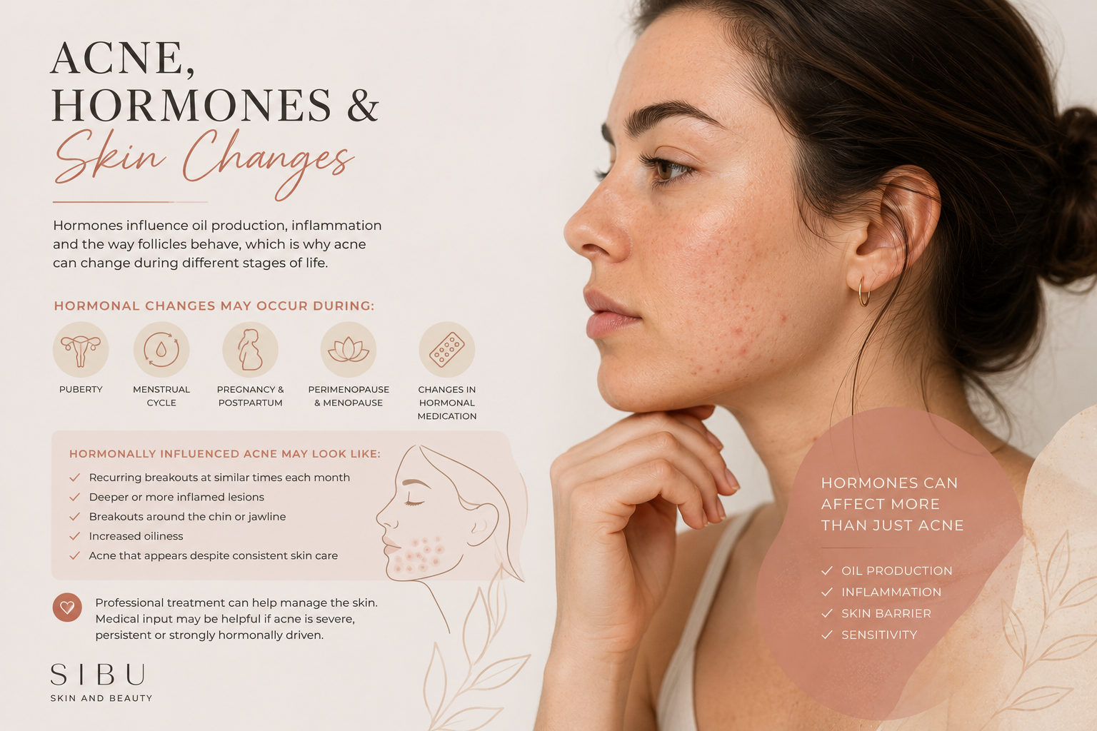 Acne, Hormones &amp; Skin Changes
