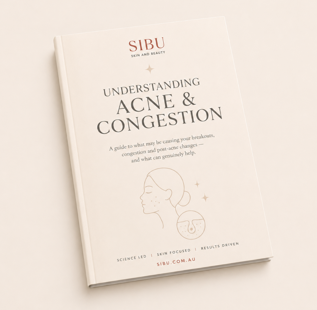 Sibu Skin and Beauty acne and congestion education guide covering breakouts, congestion and post-acne skin changes.