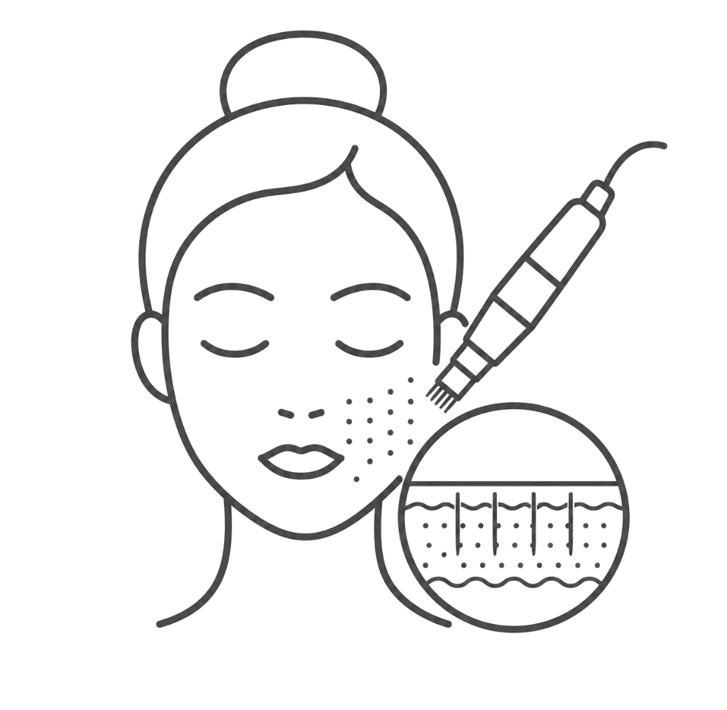 Line illustration representing Skin Needling for post-acne scarring and uneven texture.