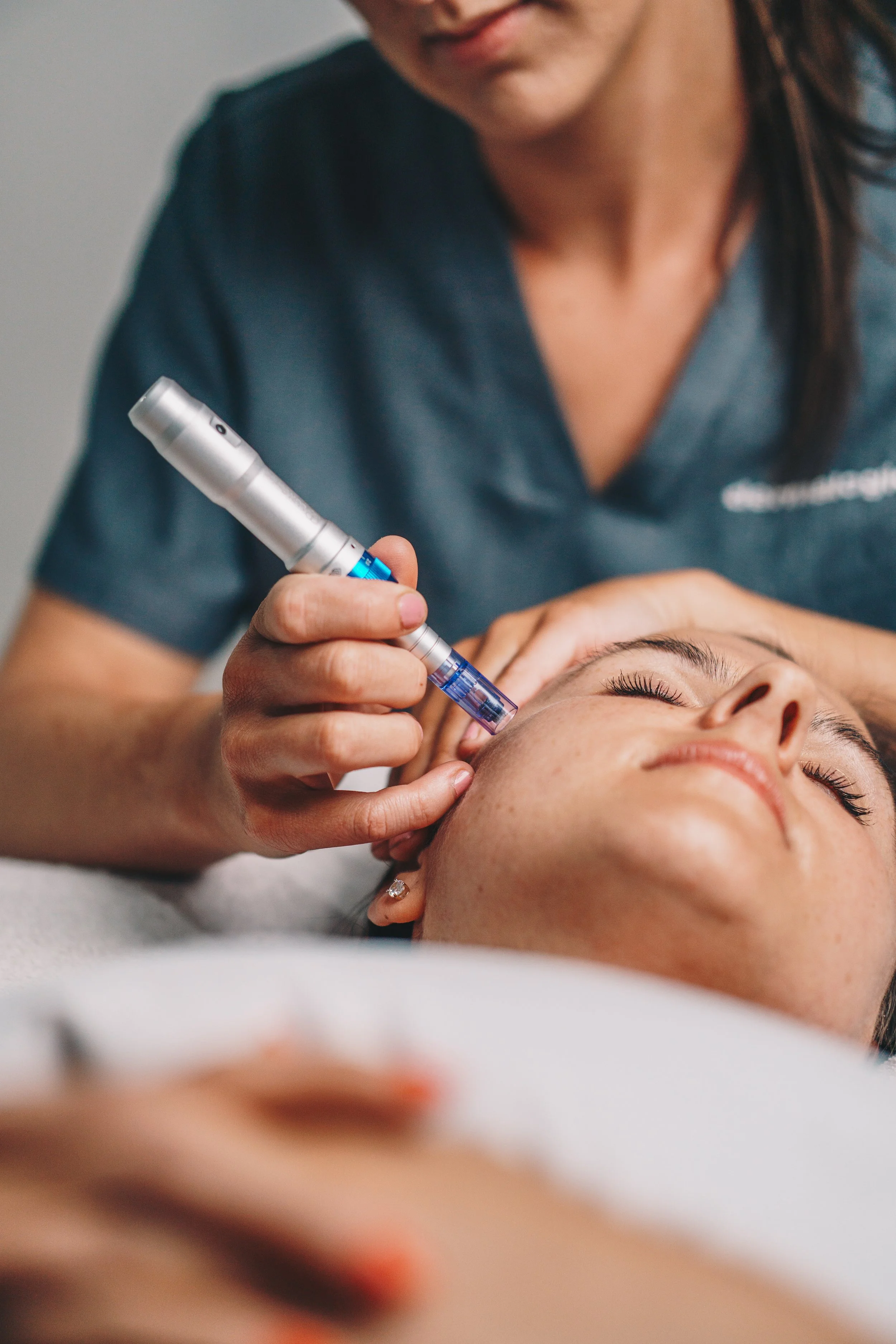 Professional skin needling treatment designed to improve skin texture, reduce acne scarring and stimulate collagen production.