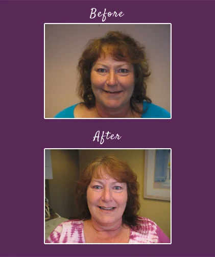 content_kris-before-after.jpg