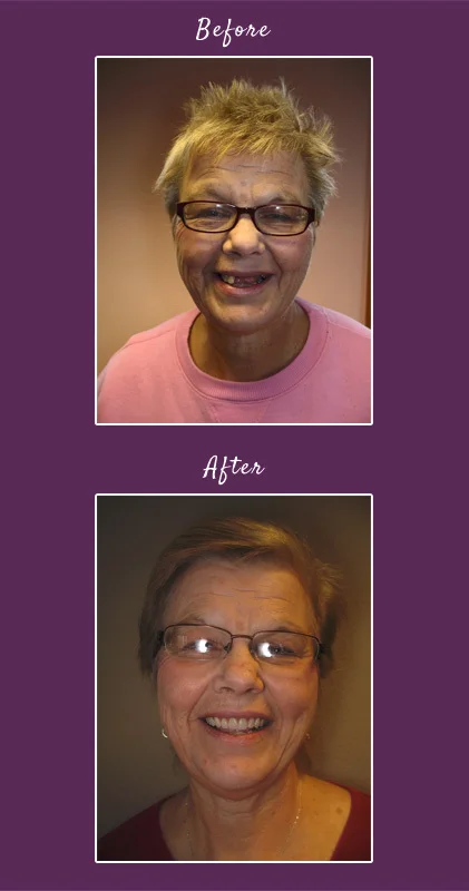 content_pam-before-after.jpg