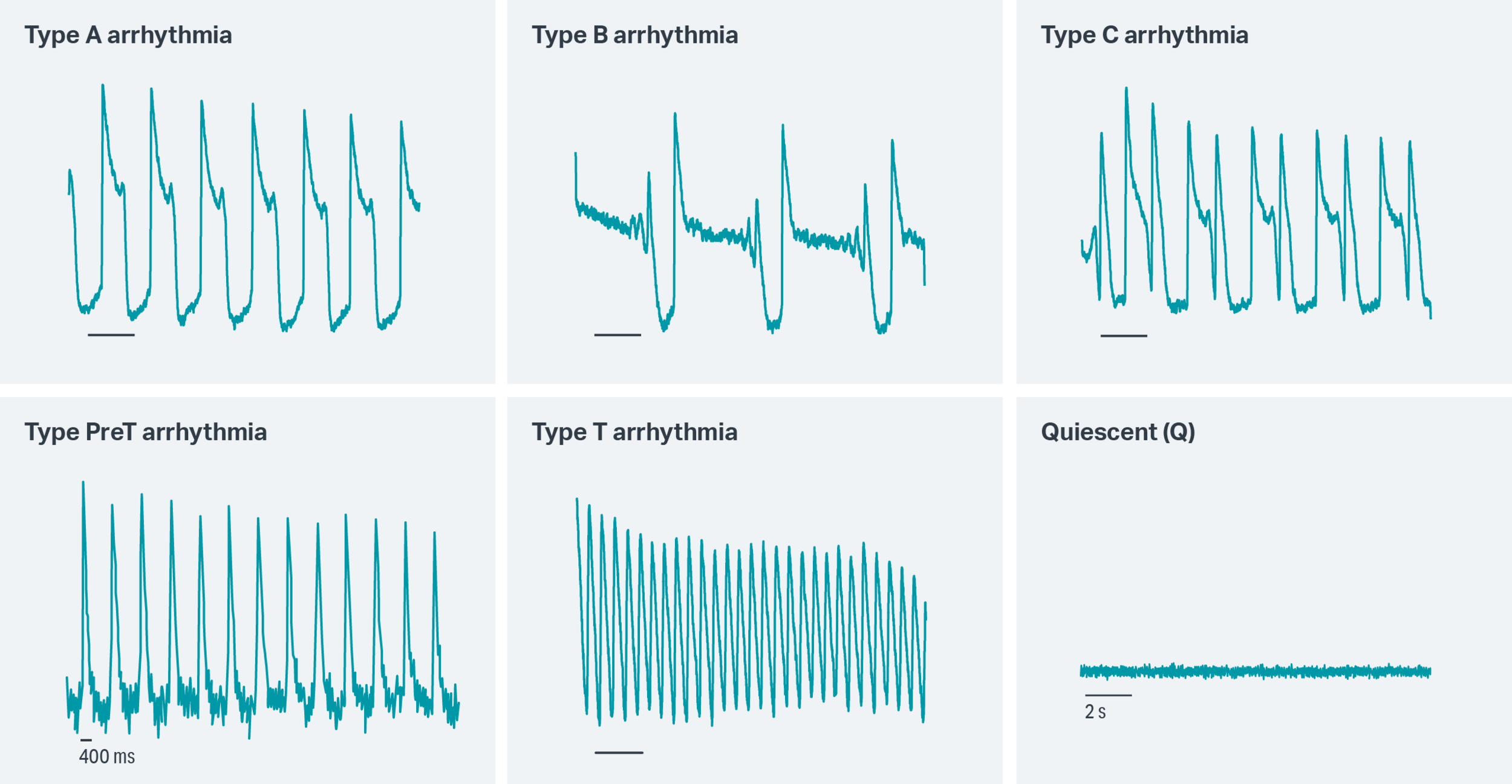 Examples of EADs Elucidated on Clydes’ CellOPTIQ platform