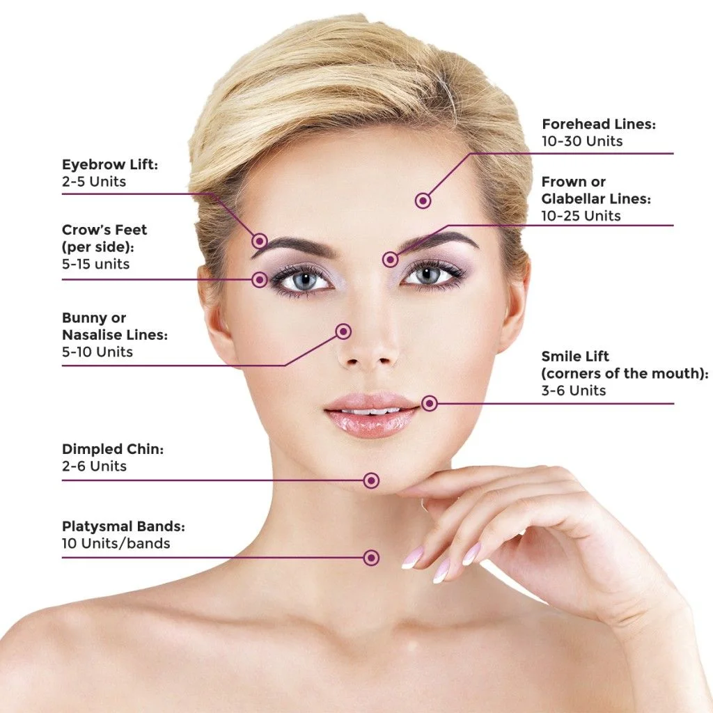 Botox_Areas.jpg