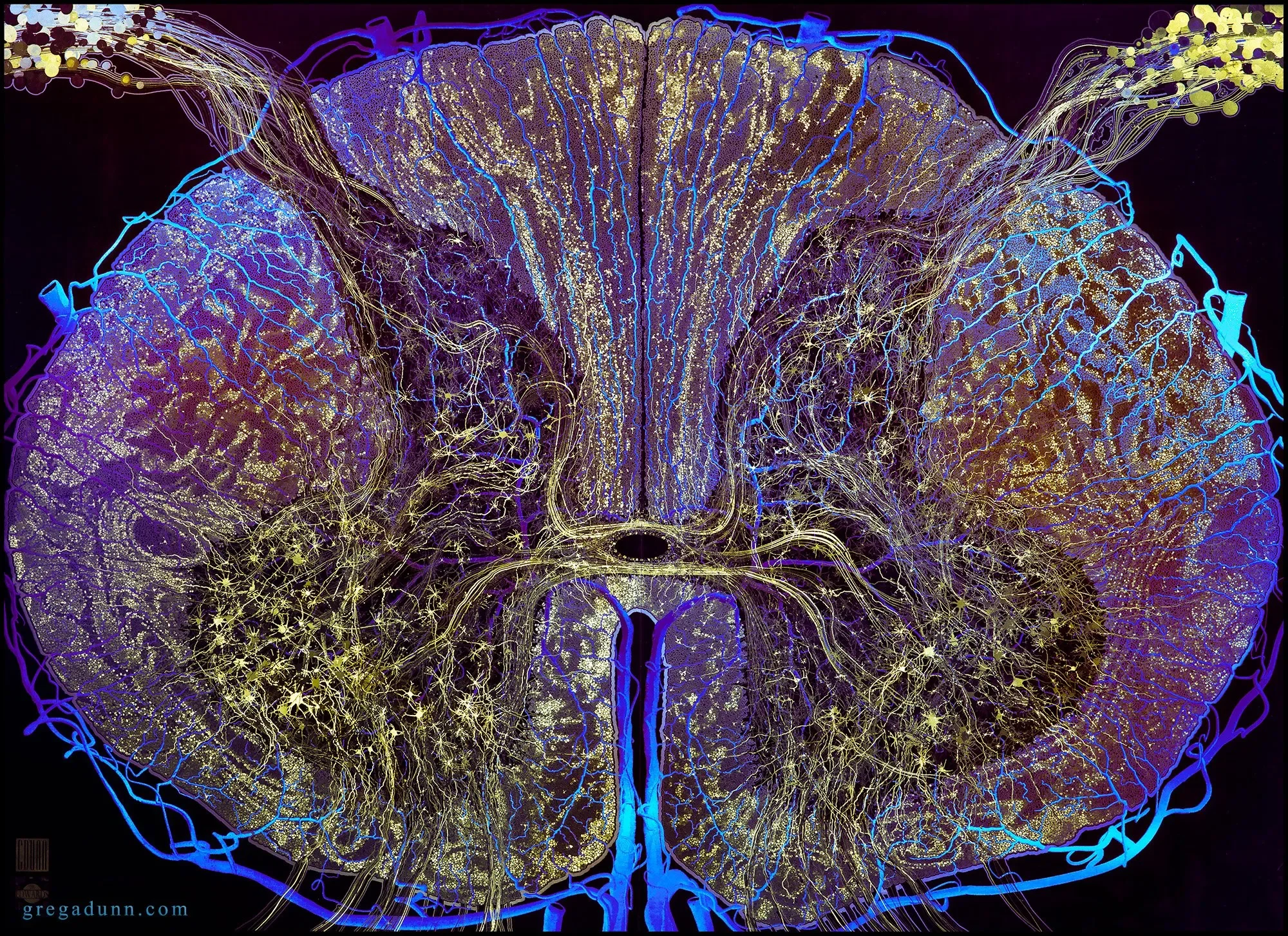 spinal-cord-2K-lines-blue-and-gold-sRGB.webp